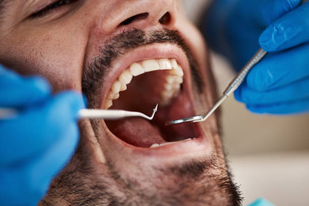 Best Emergency Dentist for Knocked-Out Tooth in Emerson, NJ